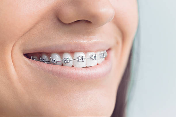 Best Full Mouth Reconstruction  in St Ann, MO
